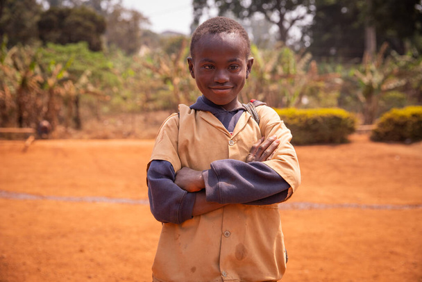 portrait of a young African child with Down syndrome, he has his arms crossed and looks at the camera - 写真・画像