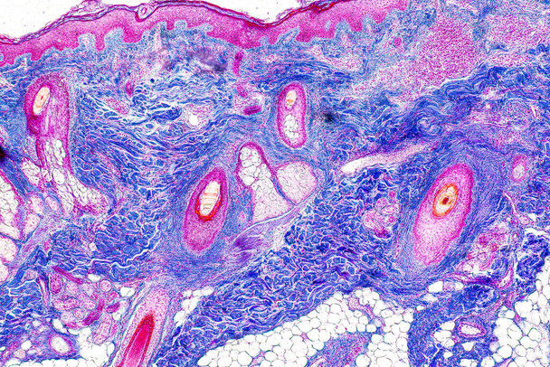 El cuero cabelludo y los folículos pilosos del ser humano bajo el microscopio en Lab. - Foto, imagen