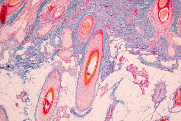 El cuero cabelludo y los folículos pilosos del ser humano bajo el microscopio en Lab. - Foto, Imagen
