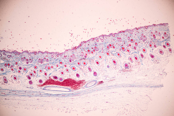 Cuir chevelu et les follicules pileux de l'homme sous le microscope en laboratoire. - Photo, image