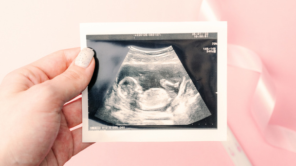 Ultraschallbild schwangeres Baby Foto. Frau Hände halten Ultraschall Schwangerschaftsbild auf rosa Hintergrund. Konzept der Schwangerschaft, Mutterschaft, Erwartung der Geburt - Foto, Bild