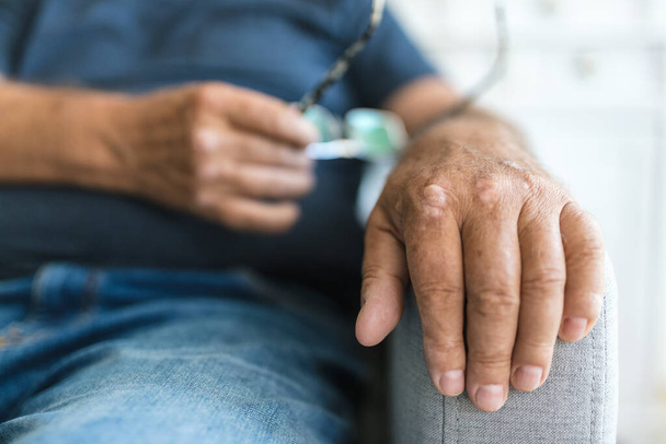 Elderly man suffering from psoriasis, closeup on hands - Фото, зображення