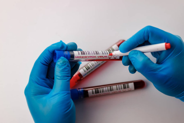 baňky s krevními testy na virus neštovic opic pozitivní a negativní - Fotografie, Obrázek