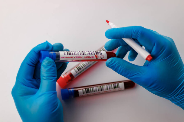 maymun çiçeği virüsü için kan testi yapılan mataralar pozitif ve negatif. - Fotoğraf, Görsel
