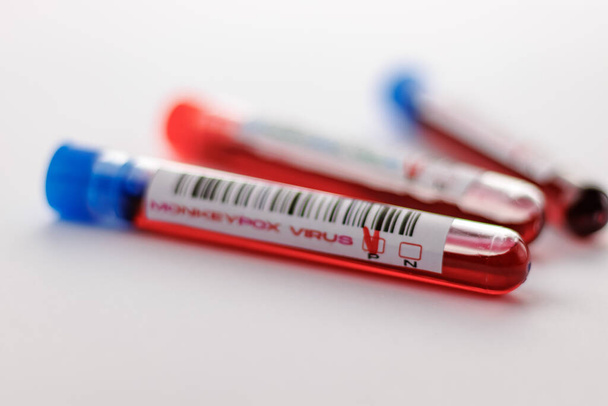 flasks with blood tests for monkey pox virus positive and negative - Fotó, kép