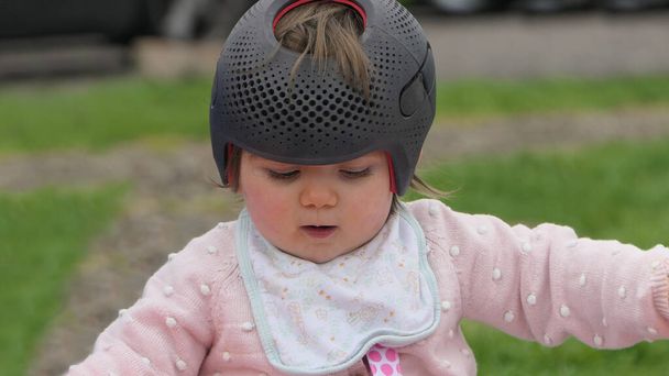 Девочка в черепном шлеме вместо плоской головы - Фото, изображение