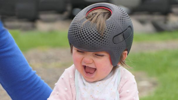 赤ちゃん女の子身に着けていますA頭蓋骨のremouldingヘルメットのためにフラットヘッド - 写真・画像