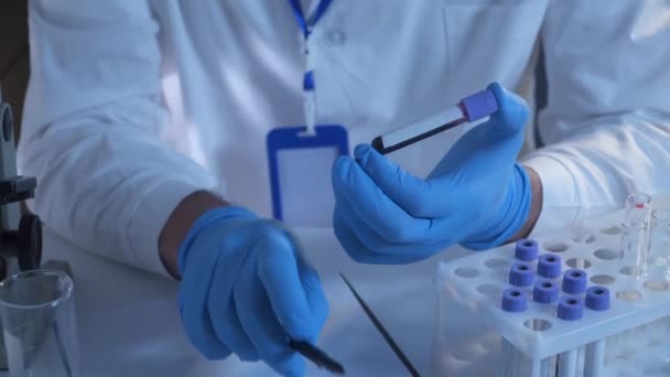 Laborant dělá testy a analýzy. Značkovače označují tenké trubičky s krevními vzorky. Na sobě modré gumové rukavice. Mikrobiologické a chemické zkoušky. Výzkumník označí vzorky krve v laboratoři. - Záběry, video