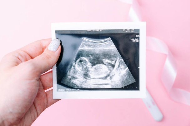 Ultrason fotoğraflı hamilelik bebeği. Kadın elleri pembe arka planda ultrason ile hamile fotoğrafı tutuyor. Gebelik, gebelik, doğum - Fotoğraf, Görsel