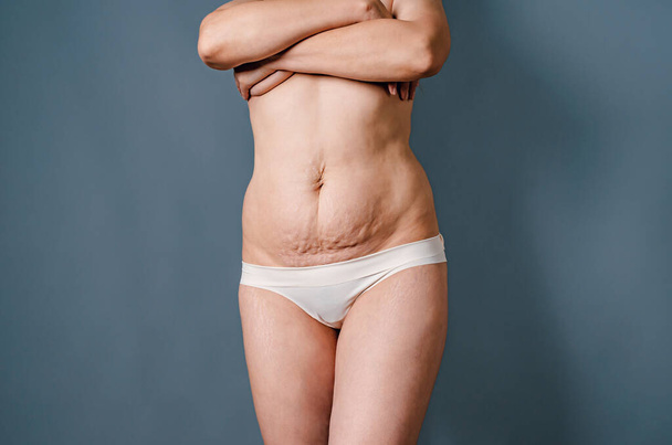 Naked female body in white lingerie after childbirth. Stretch marks on women's skin. Naked female breasts covered with hands - Fotoğraf, Görsel