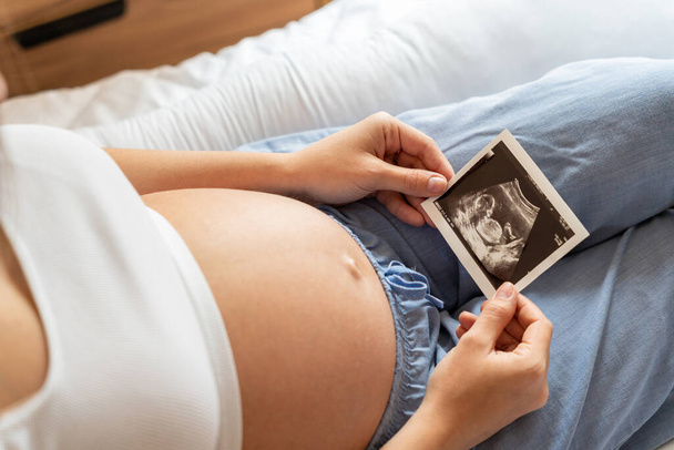Ultrason fotoğraflı hamilelik bebeği. Elinde ultrason olan hamile bir kadın. Gebelik, gebelik, doğum - Fotoğraf, Görsel