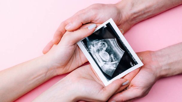 Ultrasound picture pregnant baby photo. Woman hands holding ultrasound pregnancy image on pink background. Concept of pregnancy, maternity, expectation for baby birth - 写真・画像