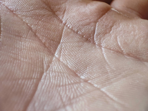 Macro menselijke huidtextuur. Blanke gezonde huid. Dermatitis concept. Helpt of ongezond detail. Huidverzorgingsachtergrond - Foto, afbeelding