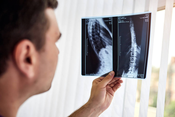 El médico traumatólogo que mira una radiografía o una radiografía en una clínica privada. Fisioterapeuta u ortopédico en el centro de rehabilitación. Concepto de medicina y salud - Foto, imagen