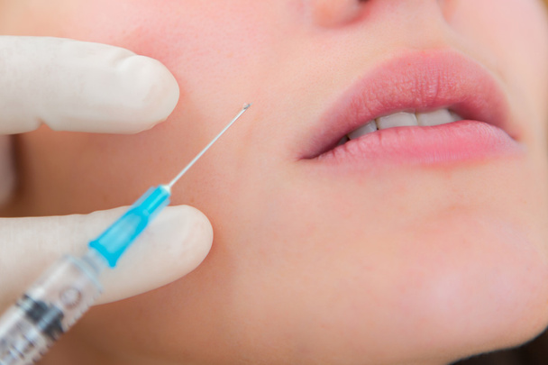 Close up view of a lip injection - Fotó, kép