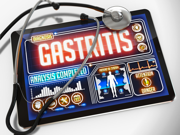 Gastrit tıp Tablet görüntüleme. - Fotoğraf, Görsel