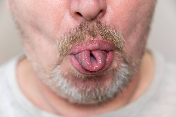 男性の顔の下の部分。頑丈な成熟した男は舌をチューブにねじれ、歯を食いしばっている。髭と口ひげに白髪。男がカメラの前でうごめいている。接近中だ。選択的焦点. - 写真・画像