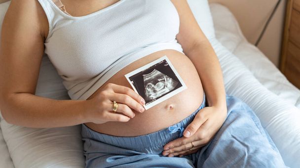 Imagen de ultrasonido embarazada bebé foto. Mujer sosteniendo imagen de embarazo por ultrasonido. Concepto de embarazo, maternidad, expectativa de parto - Foto, imagen