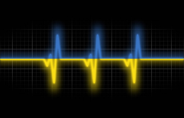 Ukrainian heartbeat, isolated on black background - Photo, Image