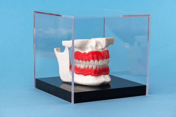 Human jaw with teeth implants anatomy model isolated on blue background in a glass box. Healthy teeth, dental care and orthodontic medical healthcare concept. Hi-quality copy space photo.  - Фото, изображение