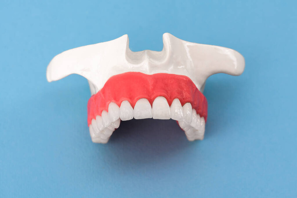 Teeth implant and crown installation process parts are isolated on a blue background. Medically accurate 3D model. Hi quality copy space photo.  - Фото, изображение