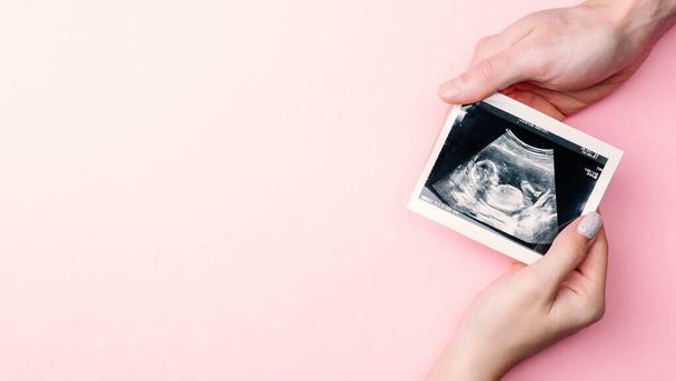 Ultrasound image pregnant baby photo. Woman hands holding ultrasound pregnancy picture on pink background. Pregnancy, medicine, pharmaceutics, health care and people concept - 写真・画像