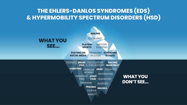 El modelo de iceberg de los síndromes de Ehlers-Danlos (EDS) y el concepto de trastorno del espectro de hipermovilidad (HDS) tiene el síntoma superficial puede ver un comportamiento feliz y normal para el análisis fisiológico y el diagnóstico  - Vector, Imagen