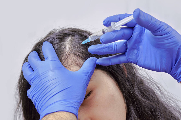 tratamento da perda de cabelo, injeção para o crescimento do cabelo. Injetado na cabeça das mulheres, mesoterapia capilar - Foto, Imagem
