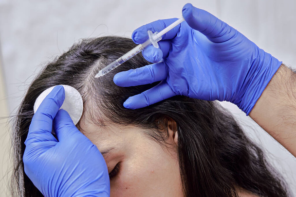 tratamento da perda de cabelo, injeção para o crescimento do cabelo. Injetado na cabeça das mulheres, mesoterapia capilar - Foto, Imagem