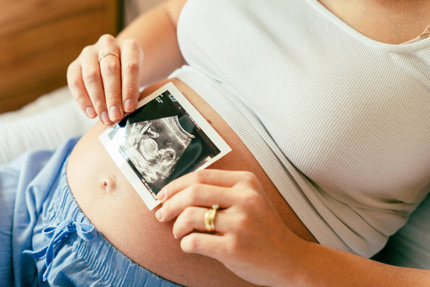 Ultrasound image pregnant baby photo. Woman holding ultrasound pregnancy picture. Pregnancy, medicine, pharmaceutics, health care and people concept - Zdjęcie, obraz