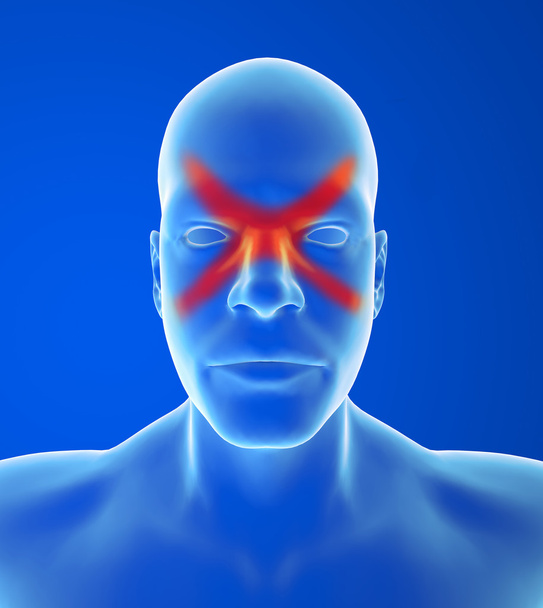 Синус головного болю
 - Фото, зображення