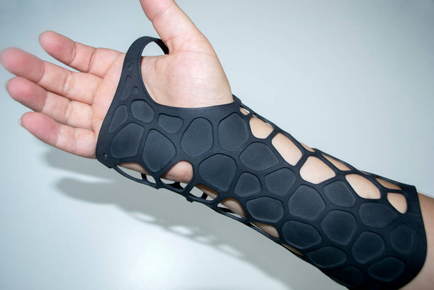 手に粉体3Dプリンタに印刷整形外科用プラスチック義肢。白い背景に隔離されている。石膏のクローズアップ.マルチジェット融合｜MJF 3Dプリント技術。現代の進歩的な添加剤技術 - 写真・画像
