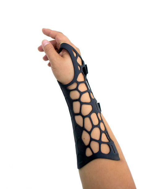 Ortopedyczna proteza z tworzywa sztucznego wydrukowana na proszkowej drukarce 3D na dłoni izolowanej na białym tle. Zbliżenie gipsu. Technologia druku 3D Multi Jet Fusion MJF. Nowoczesna postępowa technologia addytywna. - Zdjęcie, obraz