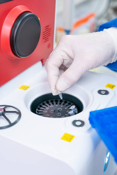 Обладнання для тестування PCR містить безбарвну судину Reaction
 - Фото, зображення