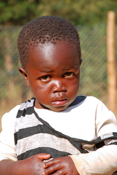 Bambini africani affetti da AIDS seguiti dalla Onlus
  - Foto, immagini