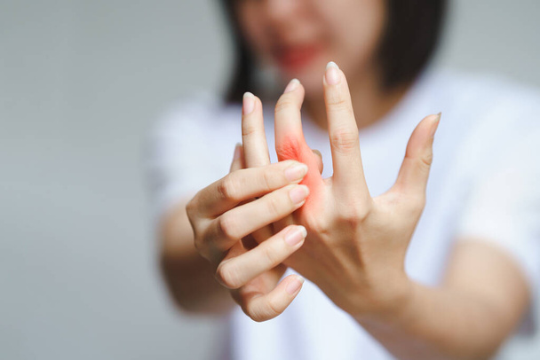 Žena má bolesti kloubů kvůli revmatoidní artritidě. Koncept zdravotní péče. - Fotografie, Obrázek