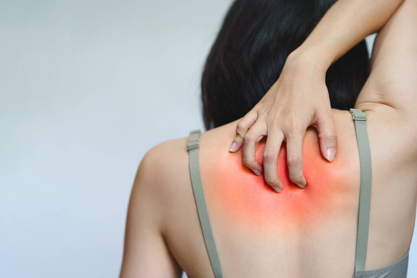 Frau kratzt sich durch Allergie am Rücken. - Foto, Bild