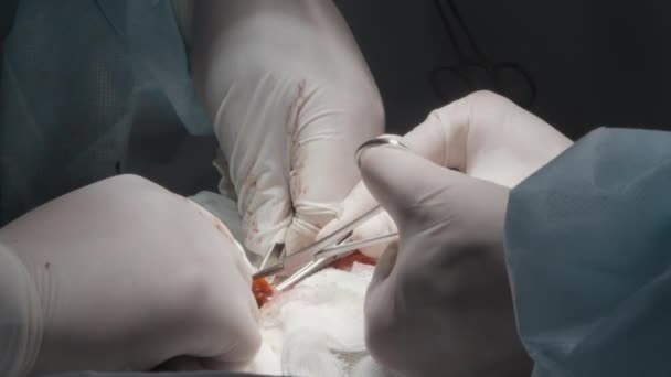 Chirurgische ingreep. Actie. Jonge specialisten die opereren met chirurgische pincet, bloed en organen die worden gesneden voor herstel zijn zichtbaar. Hoge kwaliteit 4k beeldmateriaal - Video
