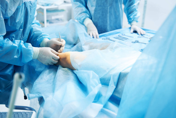 Patient undergoing surgical treatment of the knee. Medical worker using a sharp scalpel - Φωτογραφία, εικόνα