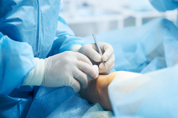 Gros plan d'un genou d'un patient et d'un chirurgien tenant un scalpel et un morceau de laine de coton - Photo, image