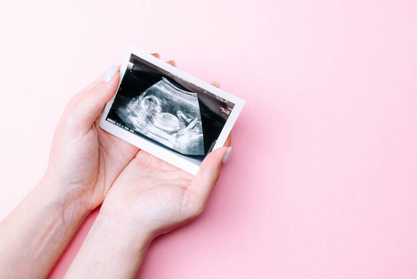 Ultrahang kép terhes baba fotó. Női kéz kezében ultrahang terhességi kép rózsaszín háttér. Terhesség, orvostudomány, gyógyszerészet, egészségügy és az emberek koncepciója - Fotó, kép