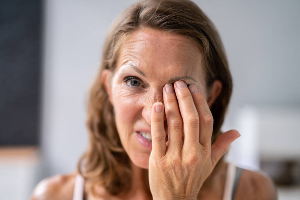 Eye Burning Pain Spasm And Fatigue. Cataract Symptoms - Fotoğraf, Görsel