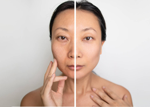 Conceito de rejuvenescimento da pele. Antes e depois da operação cosmética no fundo branco. branqueamento creme para mulheres asiáticas. - Foto, Imagem