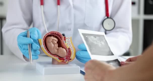 Examen ginecológico del modelo del útero y del feto del niño. Enfermedades del sistema reproductivo y concepto de tratamiento de la infertilidad - Metraje, vídeo