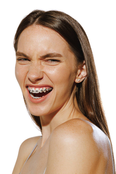Porträt eines schönen jungen Mädchens mit Zahnspange. lächelnd posiert er isoliert auf weißem Hintergrund. Zahnpflege. Schönheitskonzept, natürliche Haut, Kosmetologie, plastische Chirurgie. Kopierraum für Werbung - Foto, Bild