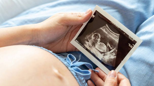Imagen de ultrasonido embarazada bebé foto. Mujer sosteniendo imagen de embarazo por ultrasonido. Concepto de embarazo, maternidad, expectativa de parto - Foto, Imagen
