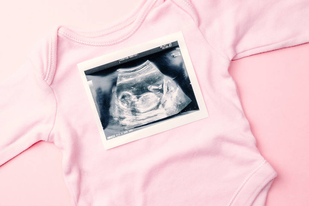 Фото беременных с ультразвуком. Модная симпатичная детская ткань со сверхзвуковым изображением беременности на розовом фоне. Беременность, медицина, медицина, медицина и люди - Фото, изображение