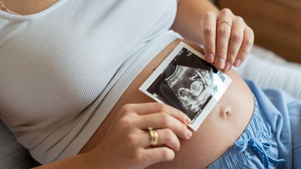 Ultrasound image pregnant baby photo. Woman holding ultrasound pregnancy picture. Pregnancy, medicine, pharmaceutics, health care and people concept - Photo, Image