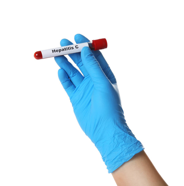 Bilim adamlarının elinde kan örneğiyle tüp var ve beyaz arka planda Hepatit C etiketi var. - Fotoğraf, Görsel