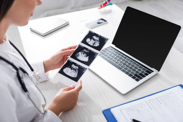Gewassen weergave van arts die ultrasone scan van baby in de buurt van klembord en laptop  - Foto, afbeelding